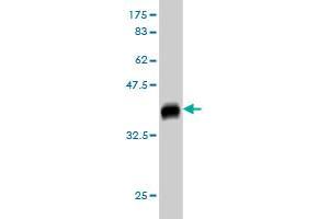 Western Blot detection against Immunogen (37. (GUCY2D 抗体  (AA 521-630))