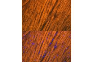 anti-Actinin, alpha 2 (ACTN2) antibody