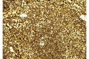 Immunohistochemistry (IHC) image for anti-CTD (Carboxy-terminal Domain, RNA Polymerase II, Polypeptide A) Small Phosphatase 1 (CTDSP1) (N-Term) antibody (ABIN6258389)