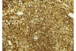 ABIN6274973 at 1/100 staining Mouse spleen tissue by IHC-P. (CTDSP1 抗体  (N-Term))