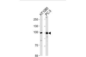 Western Blotting (WB) image for anti-Zinc Finger Protein 560 (ZNF560) antibody (ABIN3004763) (ZNF560 抗体)