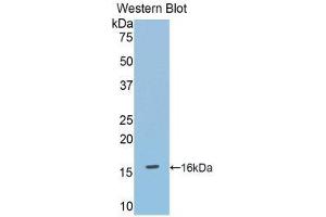 Western Blotting (WB) image for anti-Debranching Enzyme Homolog 1 (DBR1) (AA 133-241) antibody (ABIN1858612)