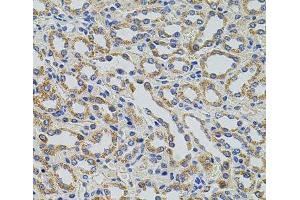 Immunohistochemistry of paraffin-embedded Rat kidney using TRMT2A Polyclonal Antibody at dilution of 1:100 (40x lens). (TRMT2A 抗体)