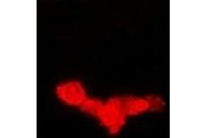 Immunofluorescent analysis of EEF1A1 staining in Hela cells. (eEF1A1 抗体)