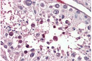 Human Testis (formalin-fixed, paraffin-embedded) stained with PIAS2 antibody ABIN461934 at 3. (PIAS2 抗体  (AA 431-445))
