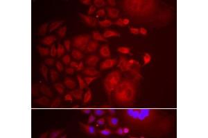Immunofluorescence analysis of U2OS cells using TRAPPC10 Polyclonal Antibody (TRAPPC10 抗体)