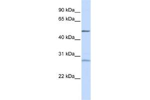WB Suggested Anti-ZNF141 Antibody Titration:  0. (ZNF141 抗体  (N-Term))