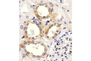staining EGF in Human kidney tissue sections by Immunohistochemistry (IHC-P - paraformaldehyde-fixed, paraffin-embedded sections). (EGF 抗体  (Center))