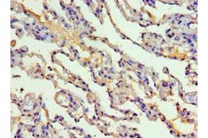Immunohistochemistry (IHC) image for anti-Cytochrome P450, Family 2, Subfamily F, Polypeptide 1 (CYP2F1) (AA 100-290) antibody (ABIN7149252)