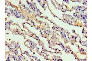 Immunohistochemistry of paraffin-embedded human lung tissue using ABIN7149252 at dilution of 1:100