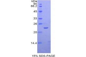 SDS-PAGE analysis of Human SIGLEC12 Protein. (SIGLEC12 蛋白)