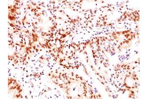 Immunohistochemistry (IHC) image for anti-Estrogen Receptor 2 (ESR2) (C-Term) antibody (ABIN6939350)