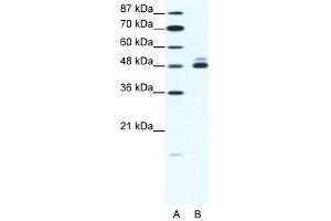 CHRNB2 antibody (20R-1324) used at 2. (CHRNB2 抗体  (N-Term))