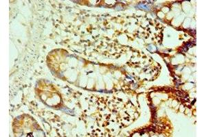 Immunohistochemistry of paraffin-embedded human small intestine tissue using ABIN7146219 at dilution of 1:100 (LI Cadherin 抗体  (AA 573-832))