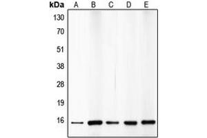 Western blot analysis of p15 INK4b expression in HepG2 (A), A549 (B), HeLa (C), mouse brain (D), rat kidney (E) whole cell lysates. (CDKN2B 抗体  (C-Term))
