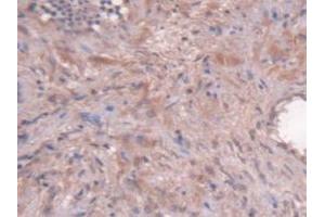 Immunohistochemistry (IHC) image for anti-Hepatitis A Virus Cellular Receptor 1 (HAVCR1) (AA 21-240) antibody (ABIN7426034)