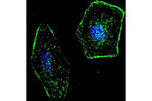 Fluorescent confocal image of SY5Y cells stained with ERAS (F66) antibody. (ERAS 抗体  (N-Term))