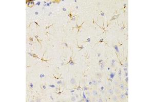 Immunohistochemistry of paraffin-embedded rat brain using KIF1B Antibody (ABIN2563552) at dilution of 1:100 (40x lens). (KIF1B 抗体)
