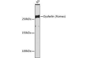 Western blot analysis of extracts of RD cells, using Dysferlin (Romeo) Rabbit mAb (ABIN7266868) at 1:1000 dilution. (Dysferlin 抗体)