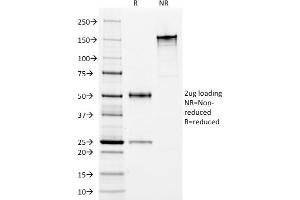 SDS-PAGE Analysis Purified HLA-DP/DR Mouse Monoclonal Antibody (Bra-14). (HLA-DPB1 & HLA-DRA 抗体)