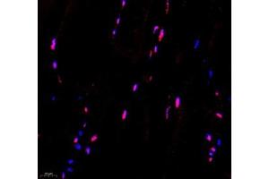 Immunofluorescence of paraffin embedded mouse Skeletal muscle using Troponin I (ABIN7076031) at dilution of 1:650 (400x lens) (TNNI2 抗体)