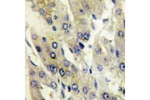 Immunohistochemical analysis of Catalase (pY386) staining in human liver formalin fixed paraffin embedded tissue section.