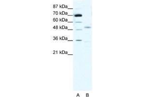 Western Blotting (WB) image for anti-Cholinergic Receptor, Nicotinic, alpha 3 (Neuronal) (CHRNA3) antibody (ABIN2463738) (CHRNA3 抗体)