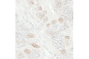 Immunohistochemistry (IHC) image for anti-Cell Division Cycle 20 Homolog (S. Cerevisiae) (CDC20) (AA 50-100) antibody (ABIN7448465)