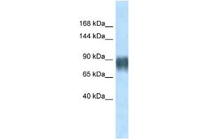 WB Suggested Anti-Avil Antibody Titration: 1. (Advillin 抗体  (N-Term))