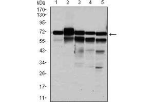 Western blot analysis using RPA1 antibody against HeLa (1), MCF-7 (2), K562 (3), A431 (4), and COS-7 (6) cell lysate. (RPA1 抗体)