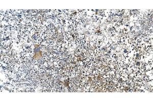 IHC analysis of DRP1/DNM1L using anti-DRP1/DNM1L antibody (ABIN7602180). (Dynamin 1-Like 抗体  (AA 618-736))