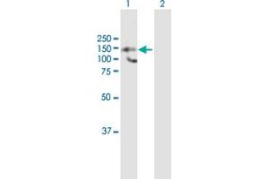 Western Blot analysis of HDAC9 expression in transfected 293T cell line by HDAC9 MaxPab polyclonal antibody. (HDAC9 抗体  (AA 1-1069))