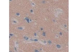 Used in DAB staining on fromalin fixed paraffin- embedded Kidney tissue (UBE2K 抗体  (AA 2-200))