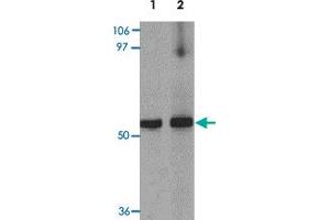 Western blot analysis of MYOZAP in rat kidney tissue lysate with GCOM1 polyclonal antibody  at 1 ug/mL (lane 1) and 2 ug/mL (lane 2). (GCOM1 抗体  (C-Term))
