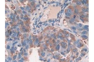 Immunohistochemistry (IHC) image for anti-Cofilin 1 (CFL1) (AA 3-161) antibody (ABIN7433783)