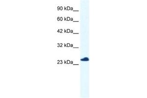 Western Blotting (WB) image for anti-Chromosome 14 Open Reading Frame 166 (C14orf166) antibody (ABIN2460980) (C14orf166 抗体)