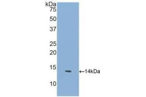 Detection of Recombinant GFRa1, Human using Polyclonal Antibody to Glial Cell Line Derived Neurotrophic Factor Receptor Alpha 1 (GFRa1) (GFRA1 抗体  (AA 239-350))