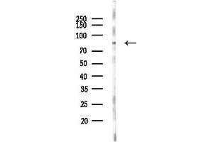 Western blot analysis of lysates from Rat testis, using PNN Antibody at 1/1000 dilution.