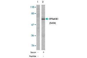 Western blot analysis of extracts from 293 cells, untreated or treated with serum (10 %, 10 min), using RPS6KB1 (phospho S424) polyclonal antibody . (RPS6KB1 抗体  (pSer424))