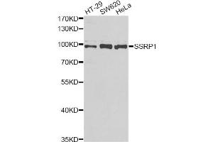 Western blot analysis of extracts of various cell lines, using SSRP1 antibody (ABIN5973814) at 1/1000 dilution. (SSRP1 抗体)