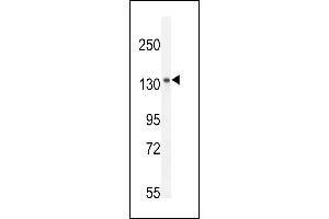 Antibody (C-term) (ABIN654917 and ABIN2844562) western blot analysis in mouse spleen tissue lysates (35 μg/lane). (K1199 抗体  (C-Term))