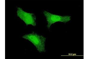 Immunofluorescence of monoclonal antibody to FGF1 on HeLa cell. (FGF1 抗体  (AA 46-155))