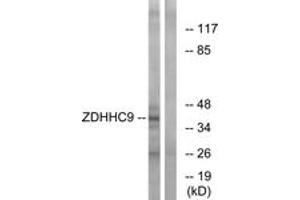 Western Blotting (WB) image for anti-Zinc Finger, DHHC-Type Containing 9 (ZDHHC9) (AA 315-364) antibody (ABIN2879195) (ZDHHC9 抗体  (AA 315-364))