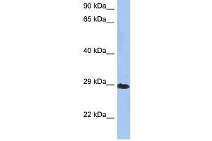 Crystallin Beta A1 antibody used at 1 ug/ml to detect target protein. (CRYBA1 抗体  (N-Term))