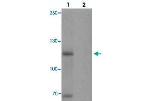 Western blot analysis of MYT1L in mouse brain tissue with MYT1L polyclonal antibody  at 1 ug/mL in (1) the absence and (2) the presence of blocking peptide.