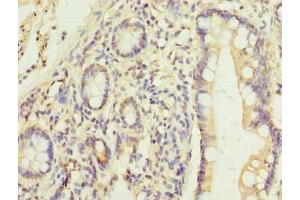 Immunohistochemistry of paraffin-embedded human small intestine tissue using ABIN7165622 at dilution of 1:100 (C17orf66 抗体  (AA 1-219))