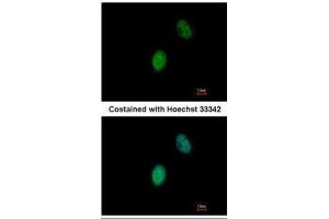 ICC/IF Image Immunofluorescence analysis of paraformaldehyde-fixed HeLa, using FHL5, antibody at 1:500 dilution. (FHL5 抗体)