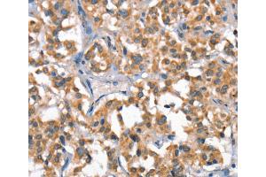 Immunohistochemistry (IHC) image for anti-Hepatocyte Growth Factor (Hepapoietin A, Scatter Factor) (HGF) antibody (ABIN2428213) (HGF 抗体)
