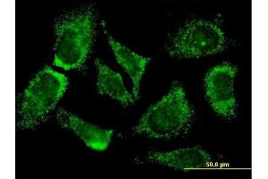 Immunofluorescence of monoclonal antibody to MOGAT3 on HeLa cell. (MOGAT3 抗体  (AA 59-107))