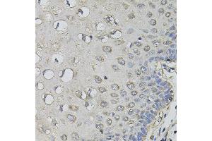 Immunohistochemistry of paraffin-embedded human esophagus using AMPD1 antibody. (AMPD1 抗体)